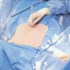 Surgical Drapes