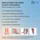 Sorgen Royale Microfiber Class 1 Thigh Length Medical Compression Stockings, SMCS1322, Size: M